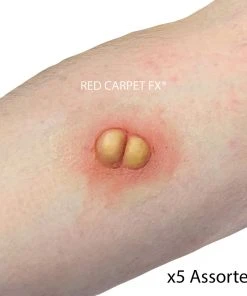 Prosthetics Monster FX Silicone Prosthetic - Boils 5 Set