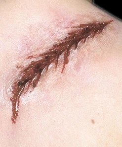 Woochie Latex Prosthetic Back Lash Prosthetics